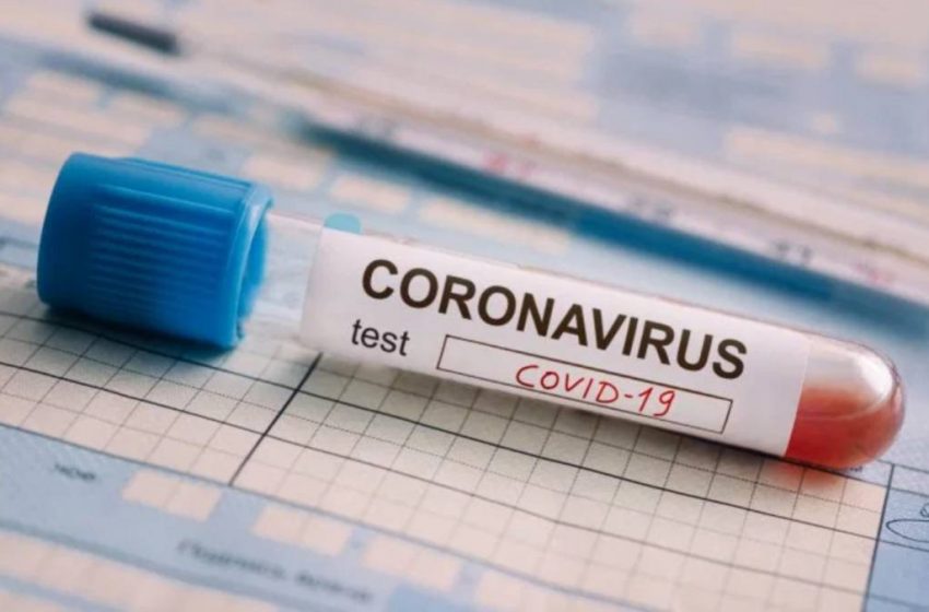  Región de Antofagasta registró 33 casos nuevos de Coronavirus