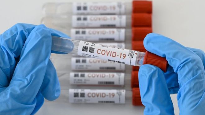  88 casos nuevos de Coronavirus en Región de Antofagasta