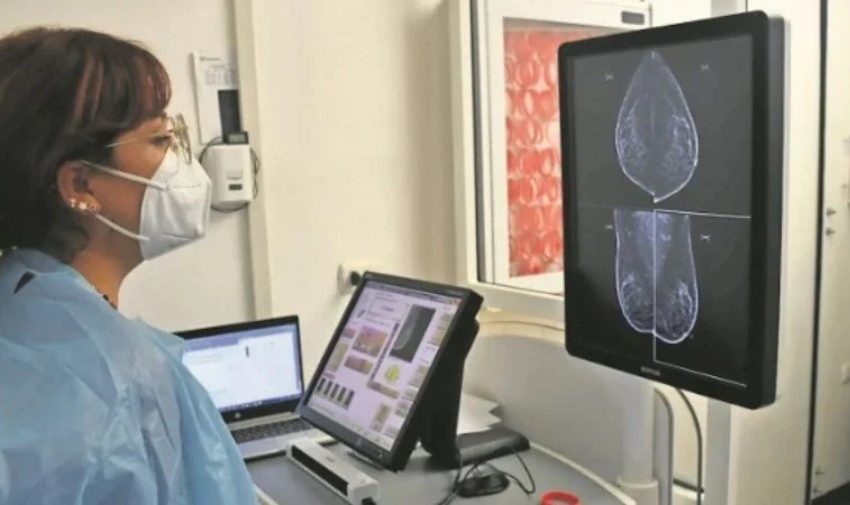 Cáncer de pulmón en Antofagasta: Características únicas y tasas alarmantes comparadas a nivel mundial