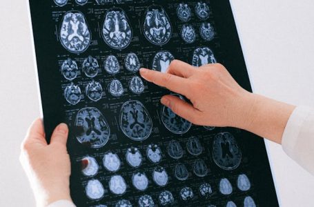 Neurotecnología para el bienestar: los cascos de estimulación cerebral llegan al mercado masivo