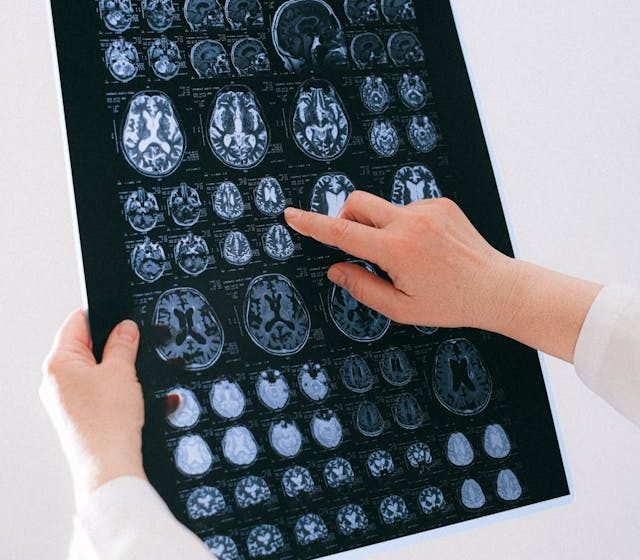  Neurotecnología para el bienestar: los cascos de estimulación cerebral llegan al mercado masivo