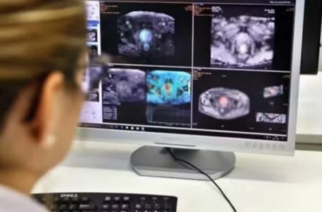 Cáncer de próstata deja 50 fallecidos en Antofagasta durante 2025: expertos refuerzan llamado al control preventivo