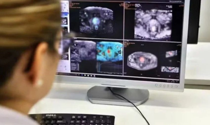 Cáncer de próstata deja 50 fallecidos en Antofagasta durante 2025: expertos refuerzan llamado al control preventivo